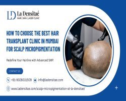 How to Choose the Best Hair Transplant Clinic in Mumbai for Scalp Micropigmentation